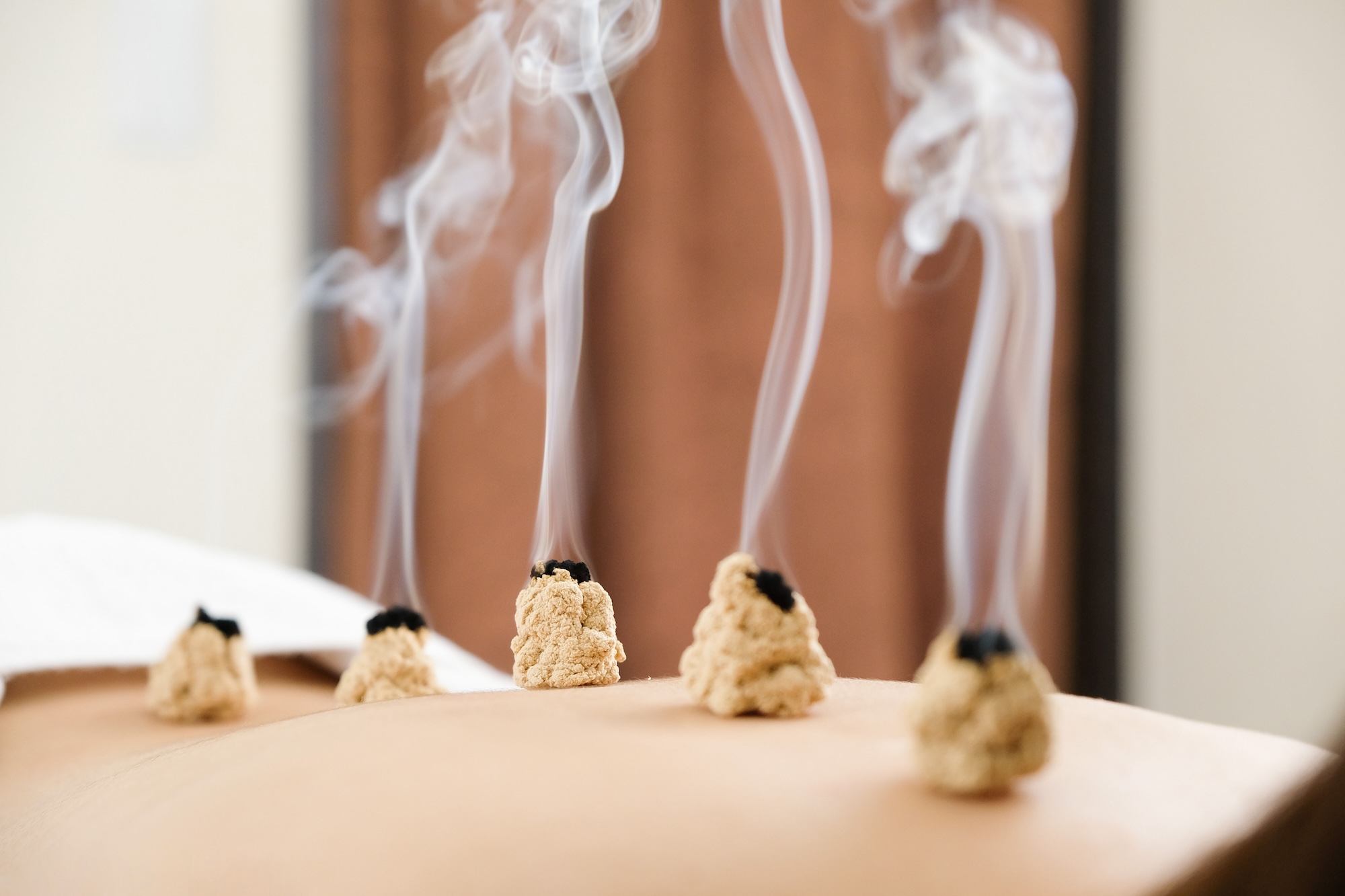 Traditional Chinese Medicine